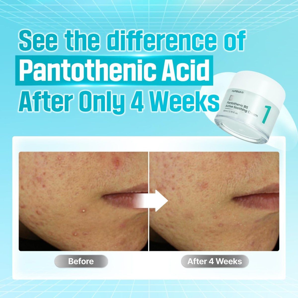 Numbuzin No.1 Pantothenic B5 Active Soothing Cream 80ml