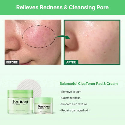 Torriden Balanceful Cica Toner Pad 180ml / 60pads